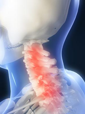 Neck pain